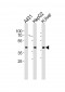 ACADSB Antibody (Center)